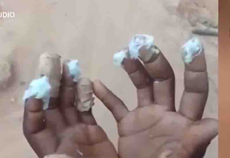 You are currently viewing Man chops off 7-year old daughter’s fingers for begging on the streets