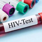 More than 23,000 persons living with HIV in western Region