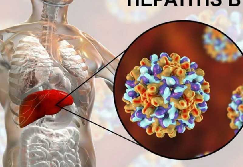 Read more about the article Hepatitis B: Traditional herbal medicines are not an alternative for a cure